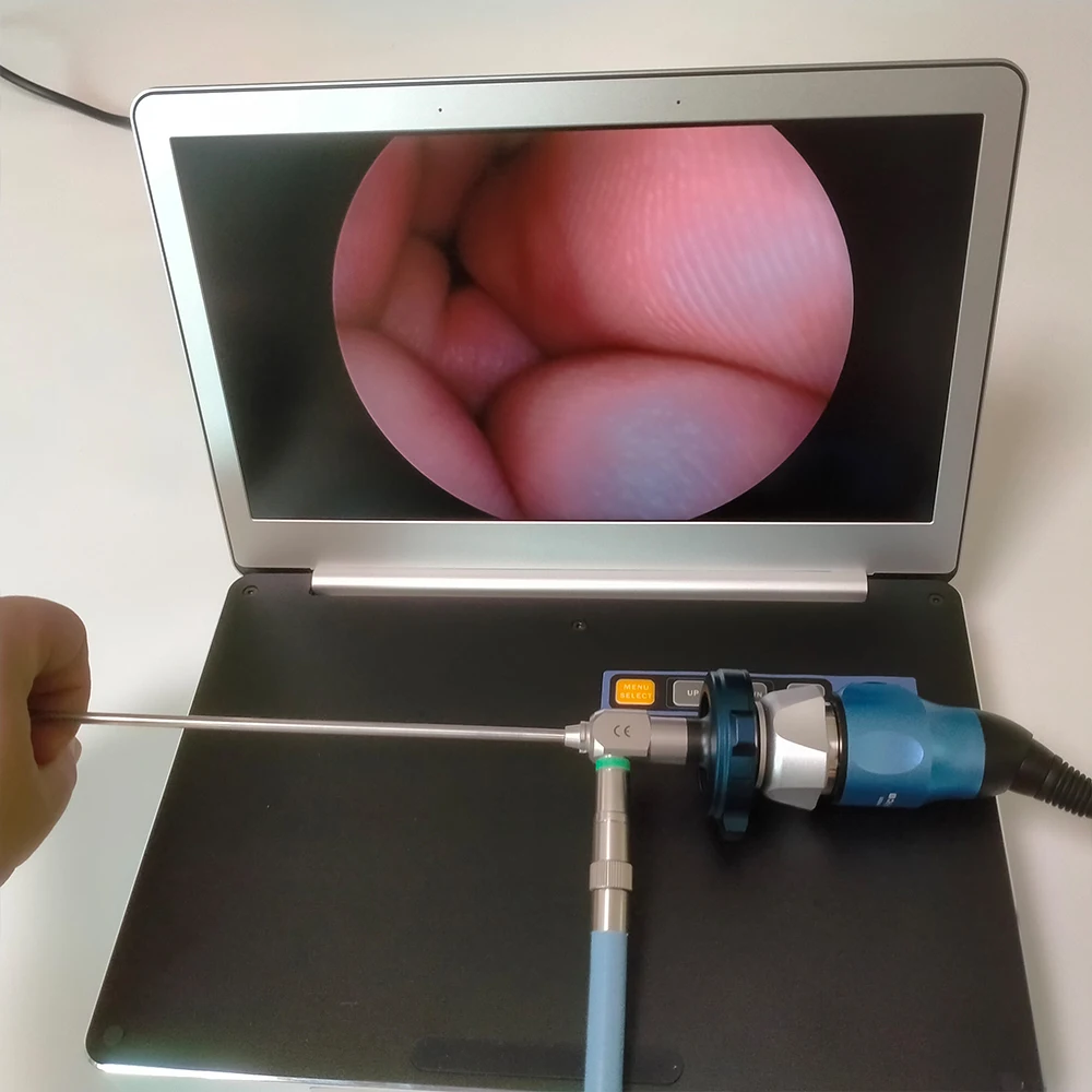 Portable Usb Endoscope Camera For Laptop, Mac, Medical Ent Hd Endoscopy Unit China Top Quality