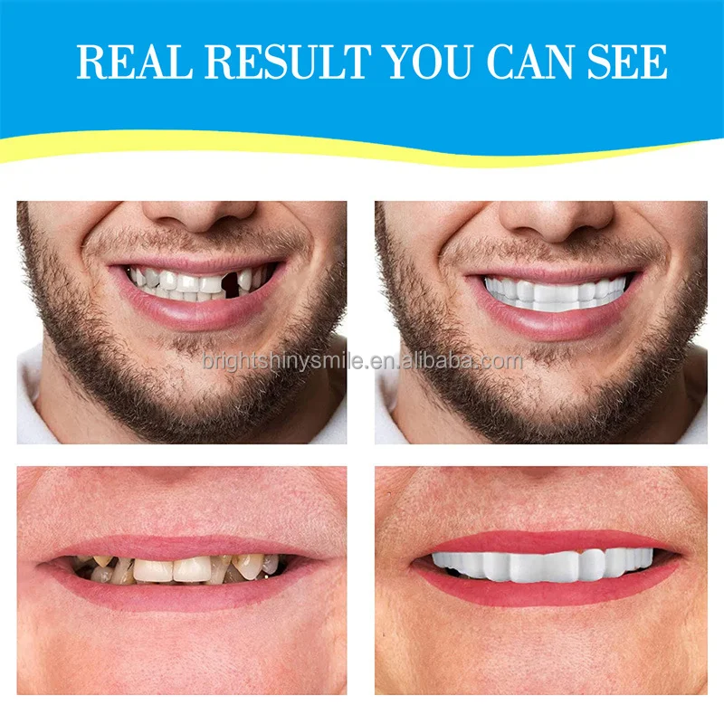 Best Selling Teeth Mouth Guard Denture Dentist Dental Retainer Custom Logo Denture Box Braces Case