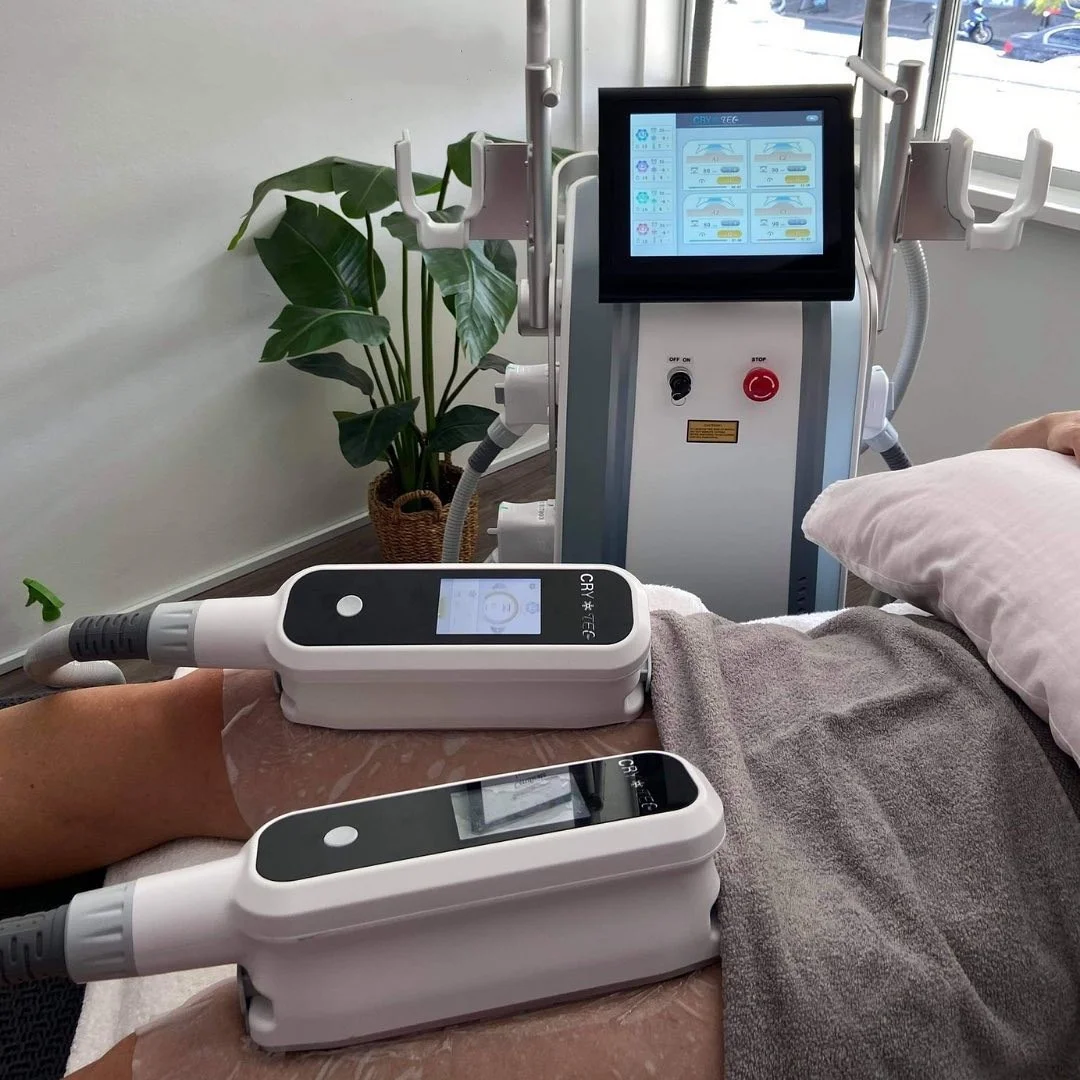 Nubway 4 cryo handles non surgical lipolysis lipolysis fat cryo cool shape machine for weight loss