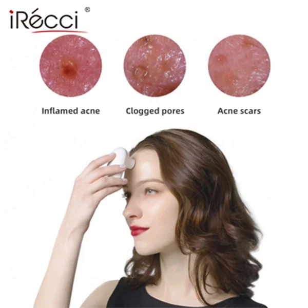 iRecci facial skin pigment scanner analysis device digital face skin dsiagnosis portable handheld skin scanner analyzer for beau