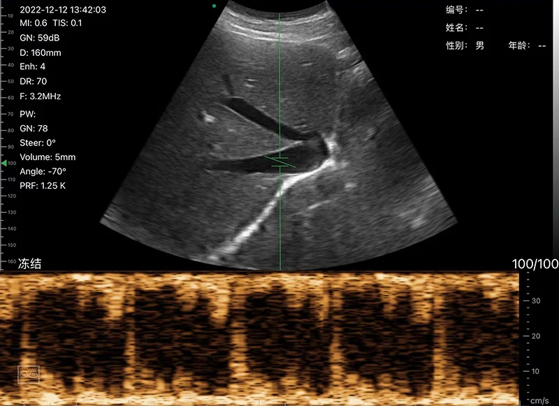 Emergency Ultrasound Device