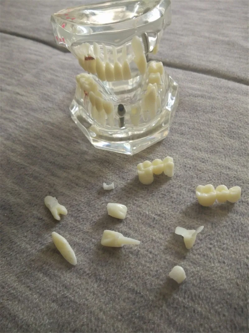 teeth can be removable dental activity pathological model teeth model