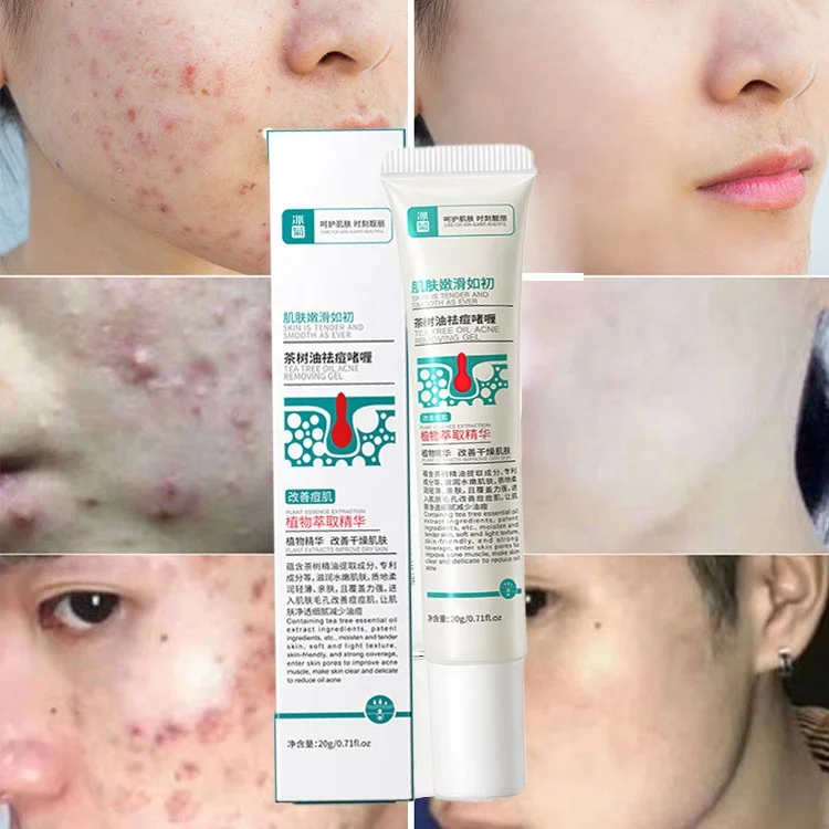 Fast Effective Face Care Anti Spots Tea Tree Repair Removal Acne Cream Scar Blackhead Acne Treatment Cream