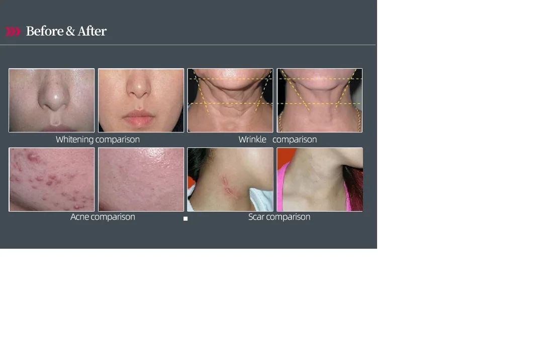 pdt led Machine pdt sauna capsule far infrared light Lamp 7 color led light facial PDT led for salon