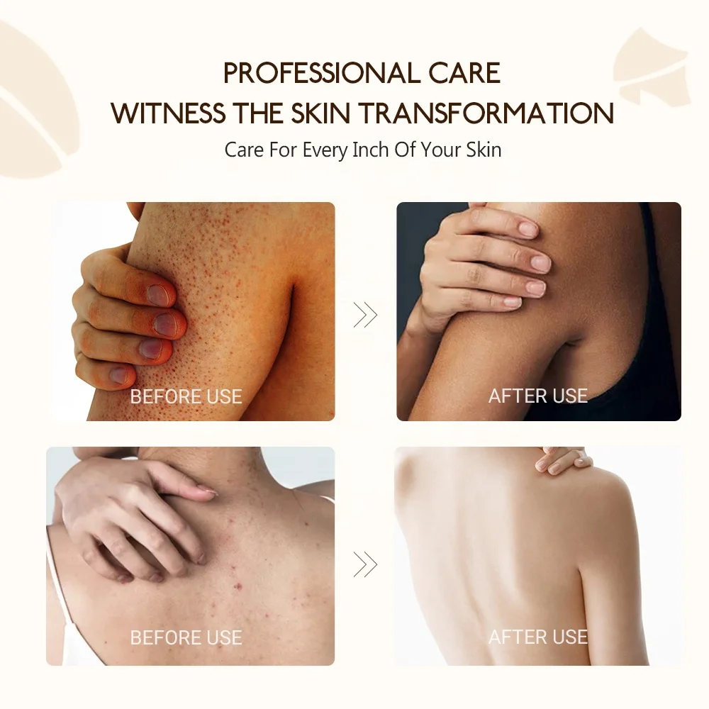 Amazon Private Label Exfoliating Body Polish Gommage Corps Anti Cellulite Stretch Marks Detox Arabica Coffee Scrub