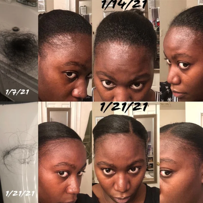 60ml Fast Hair Regrowth Serum Black Seed Castor Hair Growth Serum Oil Thick Hair Fast Growth For Black Women_4