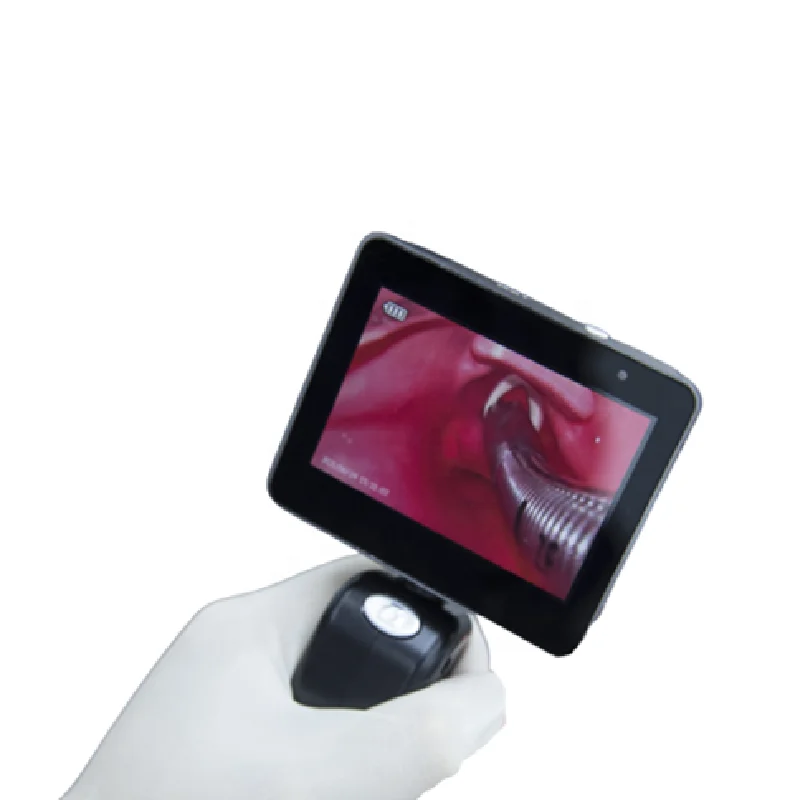 Medical grade Portable Medical Visual laryngopharyngeal mirror 3 inch OLED screen  video Laryngoscope for ENT