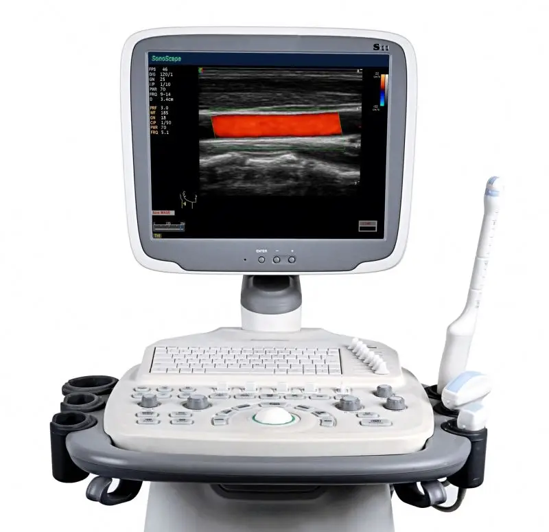 Review China movable SonoScape S11 color Sonoscape Ultrasound system ultrasouned machine cost