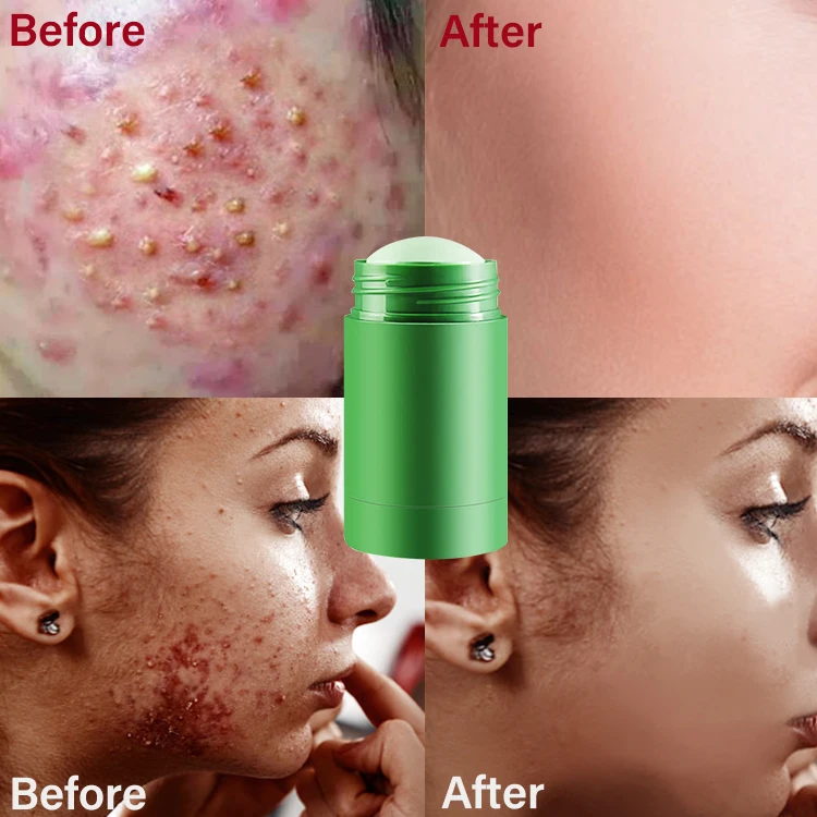 green tea facial stick private label deep cleansing acne reducing high quality mask stick