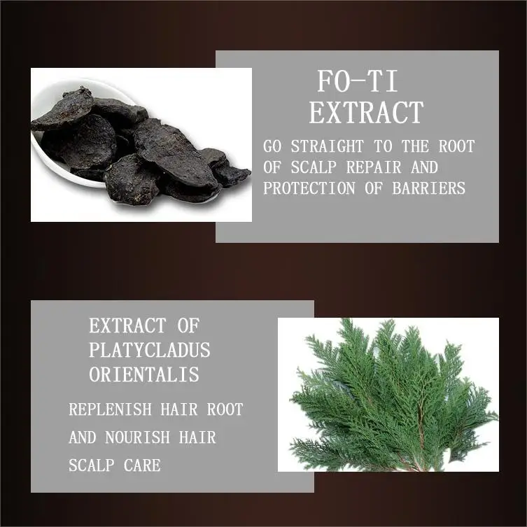 Anti-dandruff, oil control, smooth and nourishing hair shampoo suitable for dry and fine hair