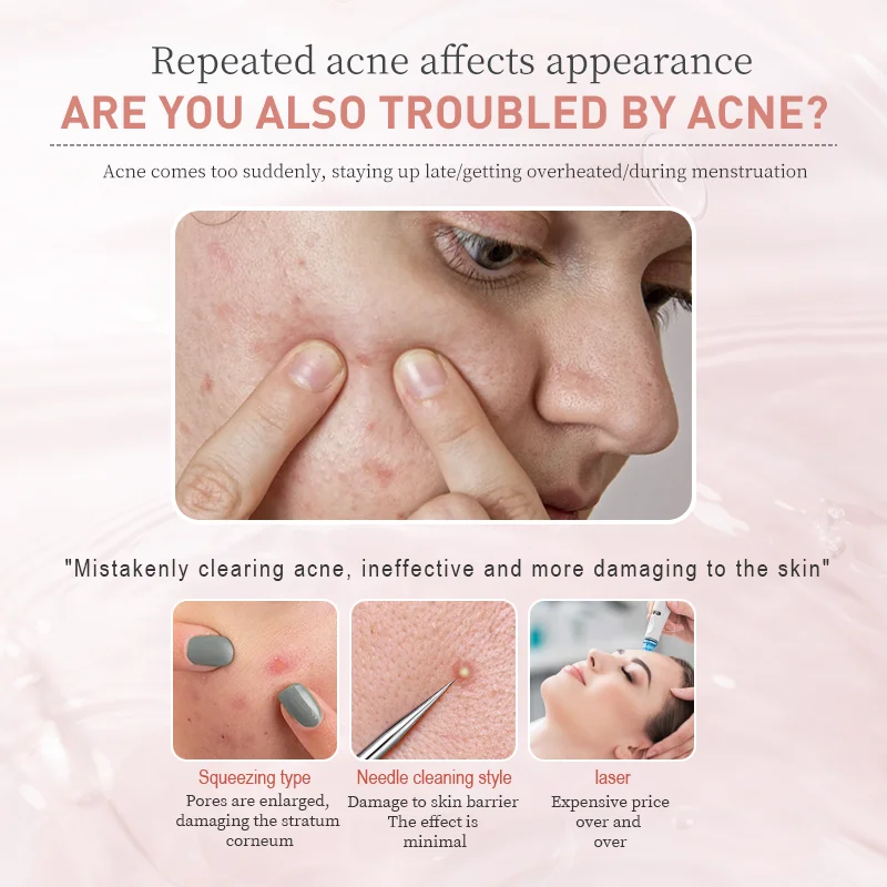 Acne Treatment Powder Water Serum One day quick action new formula