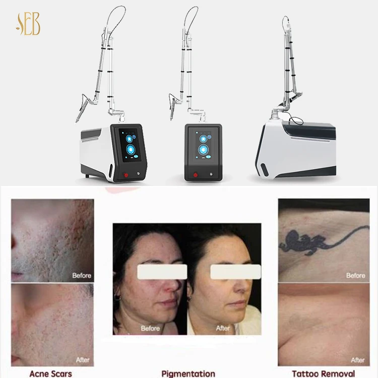 picosecond laser pico laser for tattoo removal and skin rejuvenation and pigment removal pico