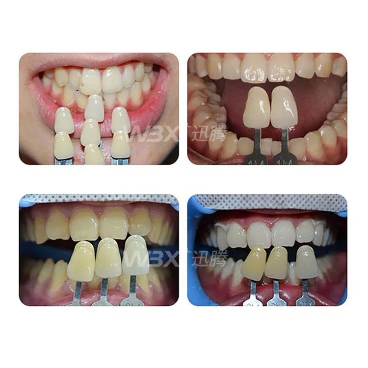 Wholesale Teeth Whitening Teeth Shade Guide dental instruments