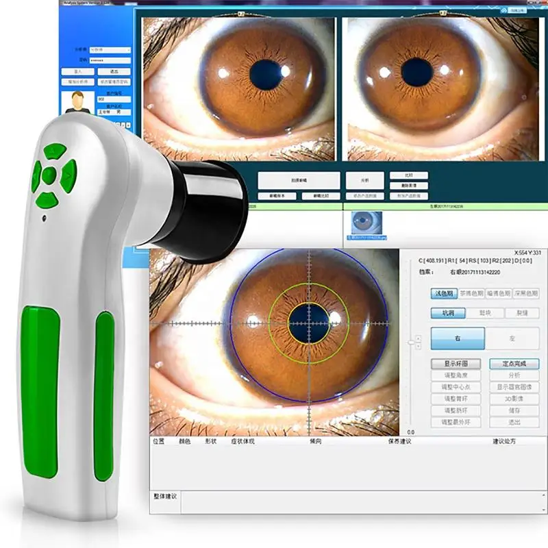 Suyzeko iris analyzer iriscope iridology camera eye iriscope camera 12mp Scanner with pro iris software