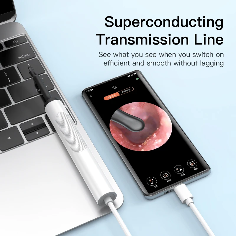 B5 5mp 4.4mm endoscope earpick smart visual ear cleaner USB ear camera