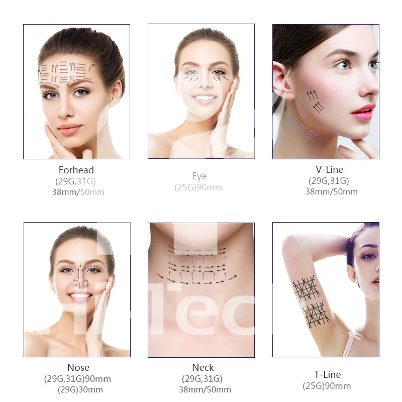 Manufacturer Supplier TOP-Q Phoenix Threads Pdo Discount Mono 29g 38mm Chin Pdo Threads Lift