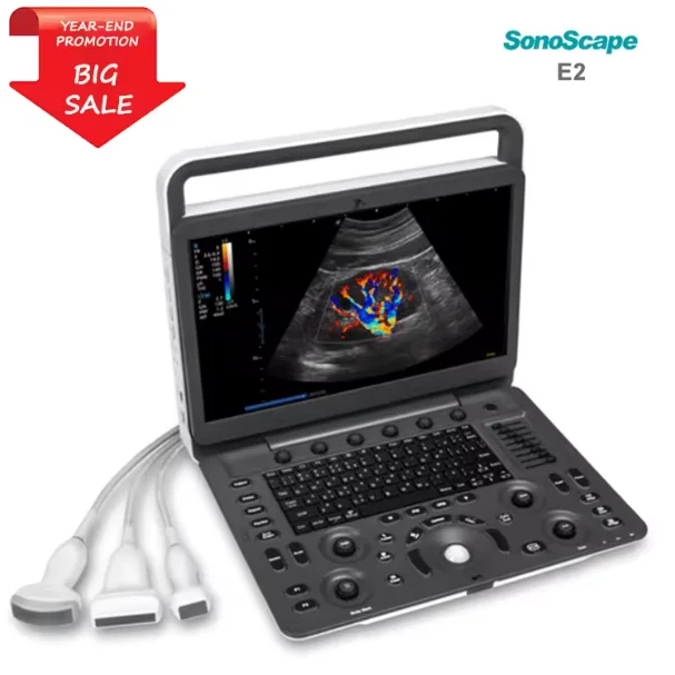AMAIN High Quality 15.6 inch Sonoscape E2 High Resolution Color Doppler Ultrasound Machine