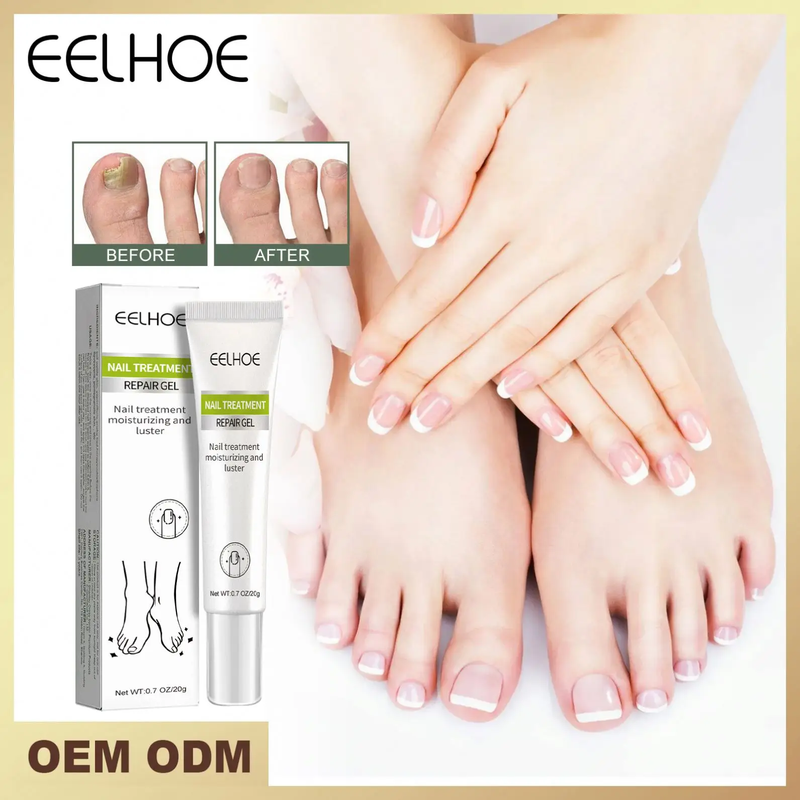 Costom Natural Organic Nail Care Paronychia Fungal Treatment Nourishing Soft Nail Repair Bad Thickening Fungal Treatment Gel 20g