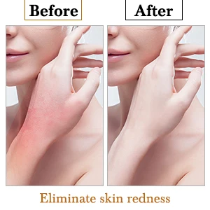 Face massage skin care tools face beauty equipment