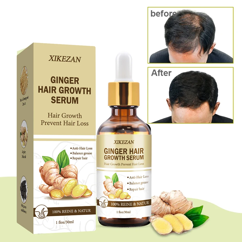 Fast-acting hair growth solution with powerful biotin and ginger extract from organic rosemary oil