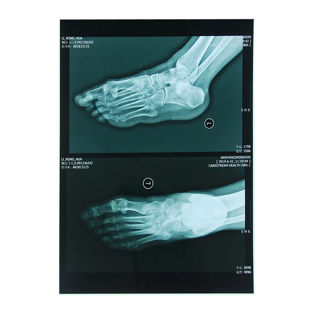 The biggest sales event of CT MR MRI DR film