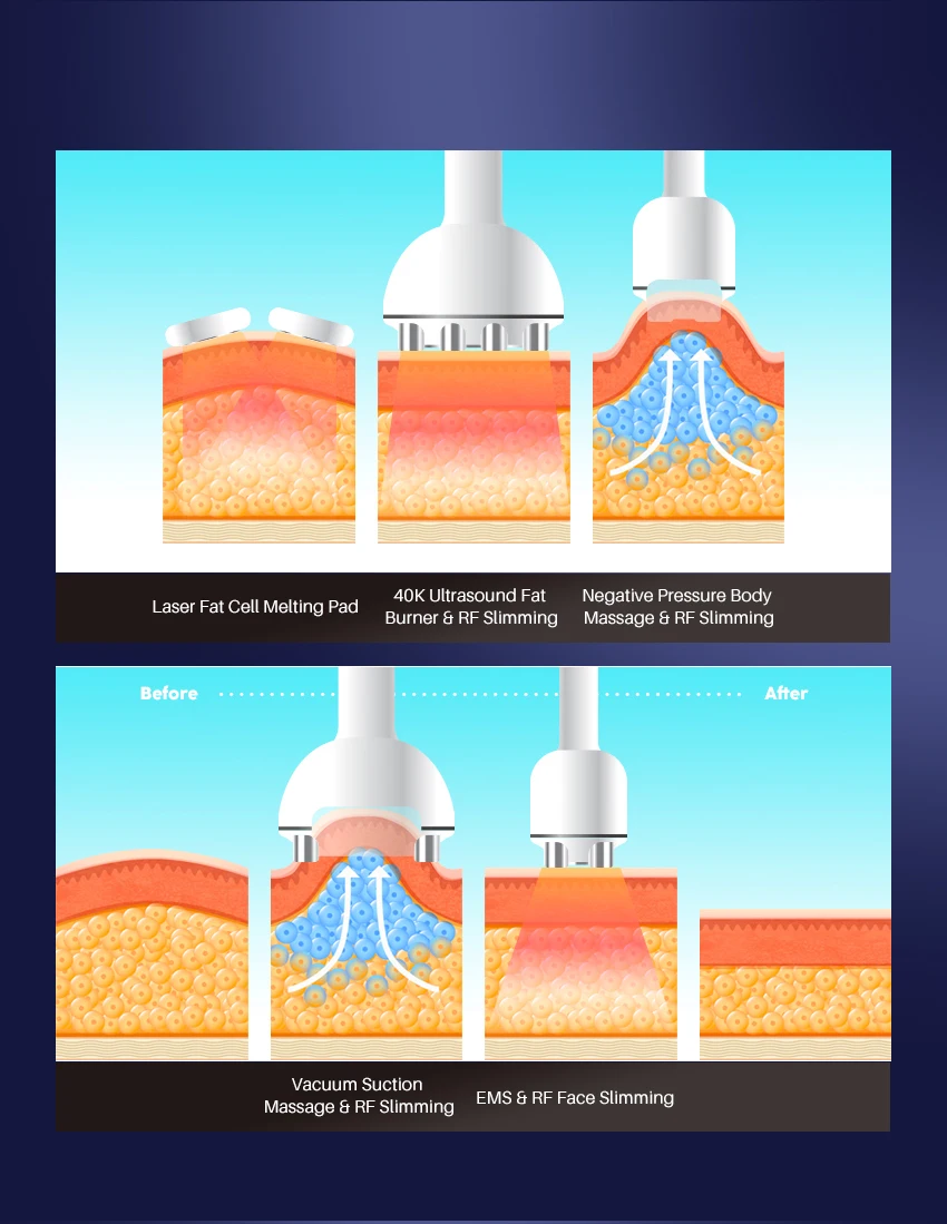 5 in 1 40k Radio frequency cavitation skin tightening ultrasound Laser Lipolaser Body Molding Massage slimming machine