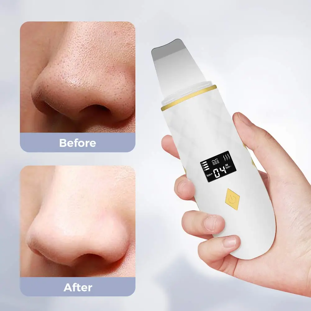 newest  Heated Ultrasonic Skin Care Scrubber Deep Face Cleaning Blackhead Acne Removal Pore Cleanser Peeling Skin Care Tool