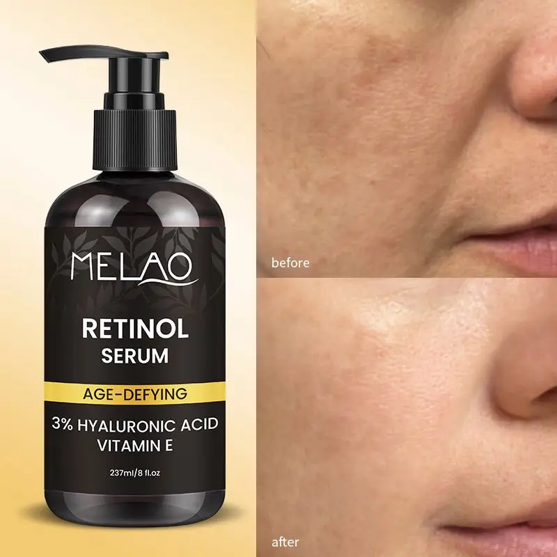 New Arrival Dry Sensitive Facial Serums Niacinamide Dark Age Spots And Fine Lines Facial Serum Retinol Collagen Essence