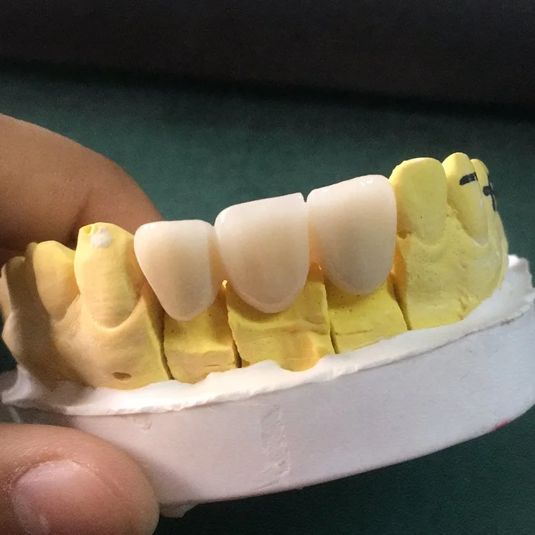 
China most popular JD-TX5 5 axis dental lab CAD CAM milling machine 