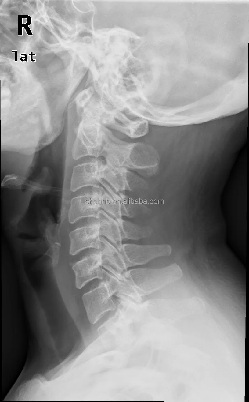 17*17 DR Multipurpose digital radiography X ray flat panel detector