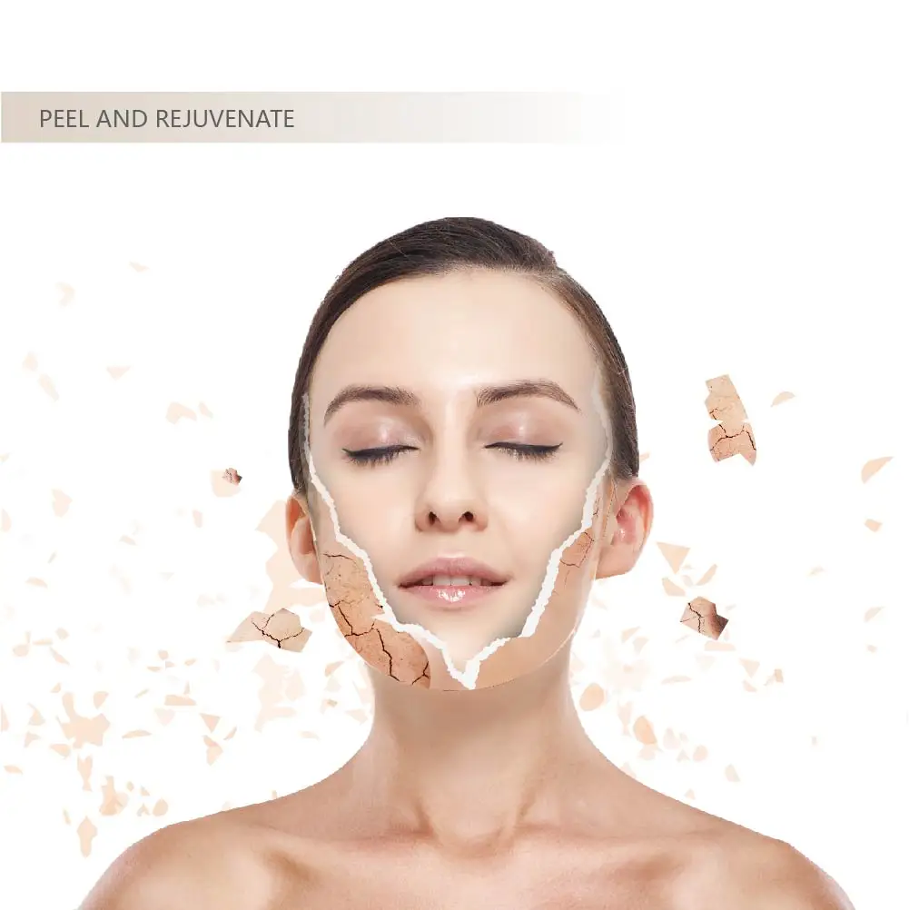 2024Y Sponge Microneedle Peel Acne Treatment Spotted stretch marks Algae Peel  Bio-microneedling For Skin Rejuvenation