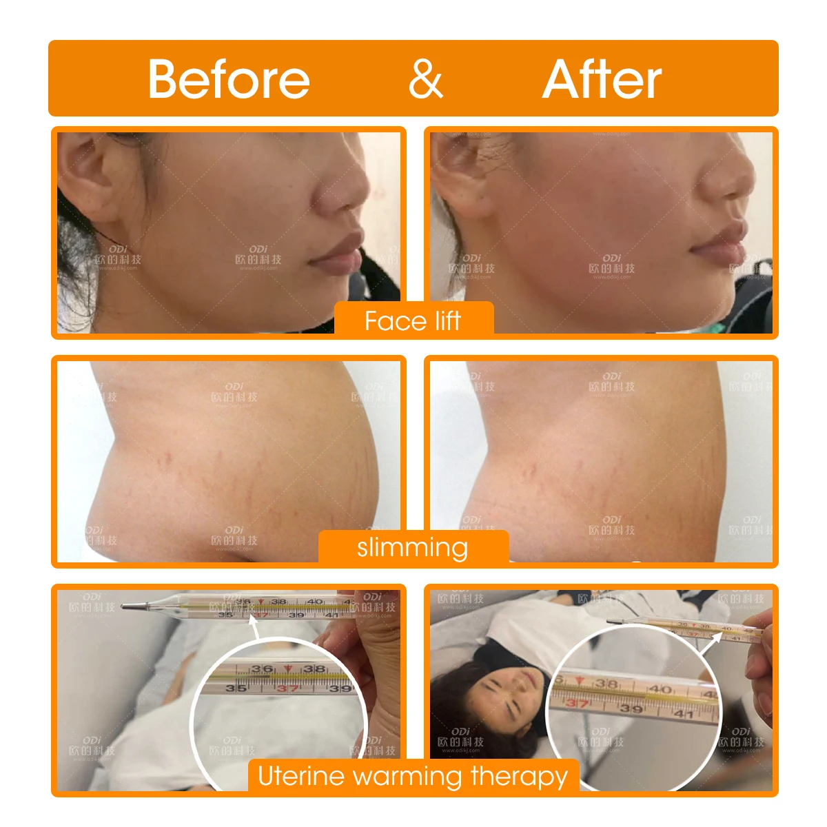 Hot Selling !! 448Khz Deep Beauty Spa Machine Body Shaping Face Lifting Machine Cet Ret Radiofrecuency Rf Equipment