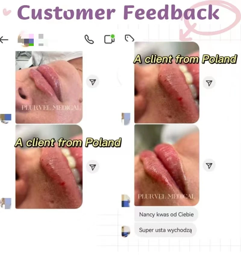 PLURVEL Hot Sale DERM 1ml Hot Sale Neuramis Deep Filler Facial Injection Dermal Filler Ha