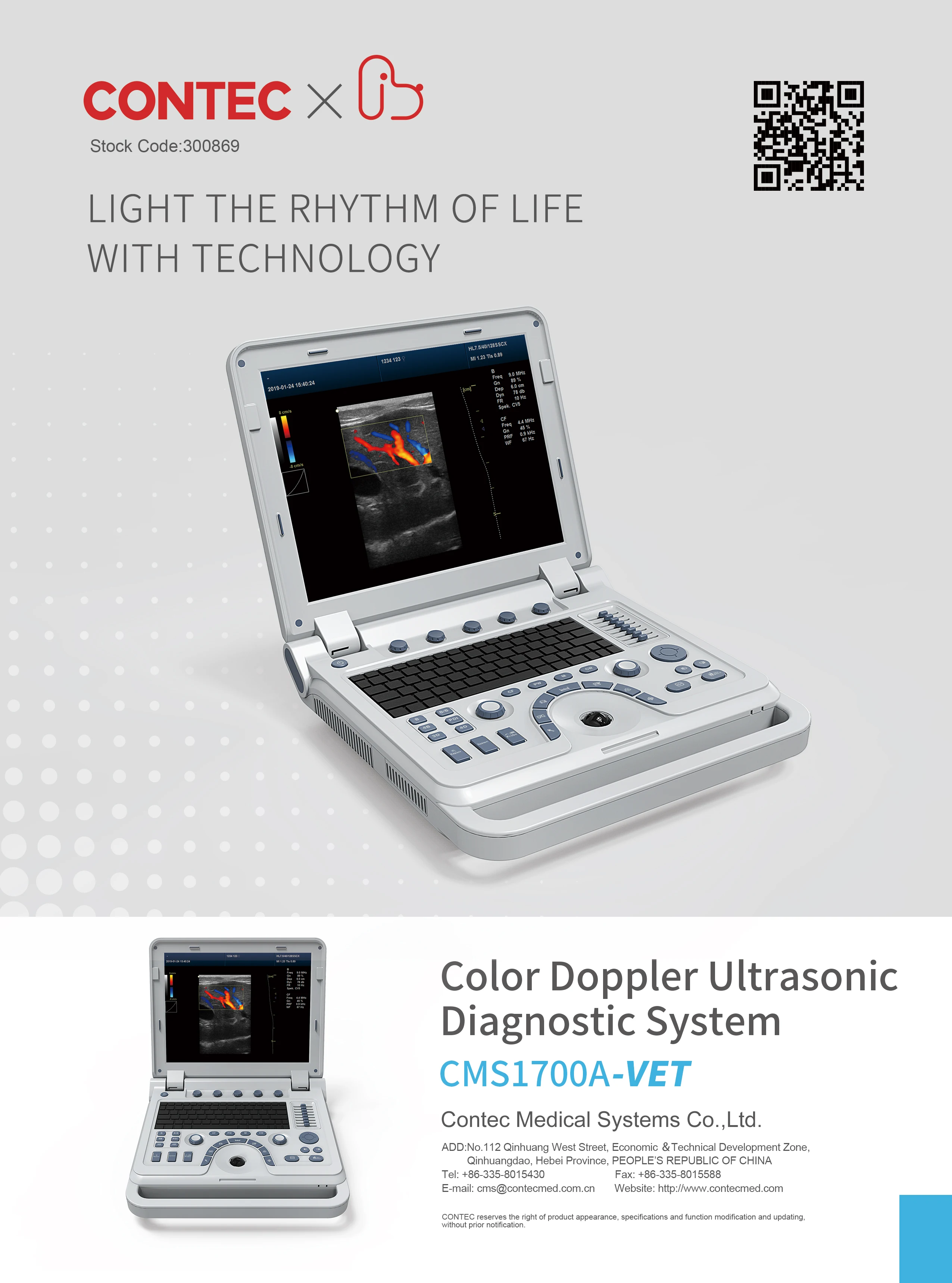 CMS1700A Low Price Laptop USG Scanner 2D Portable Ultrasound Machine Human Pregnancy USG  Probe