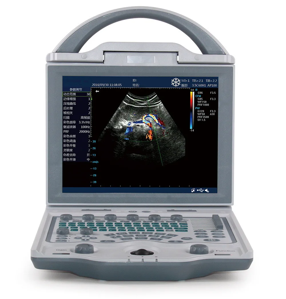 Medical Laptop Portable Ultrasonic Diagnostic Device Medical Veterinary DCU12 Ultrasound Scanner (1600367363756)