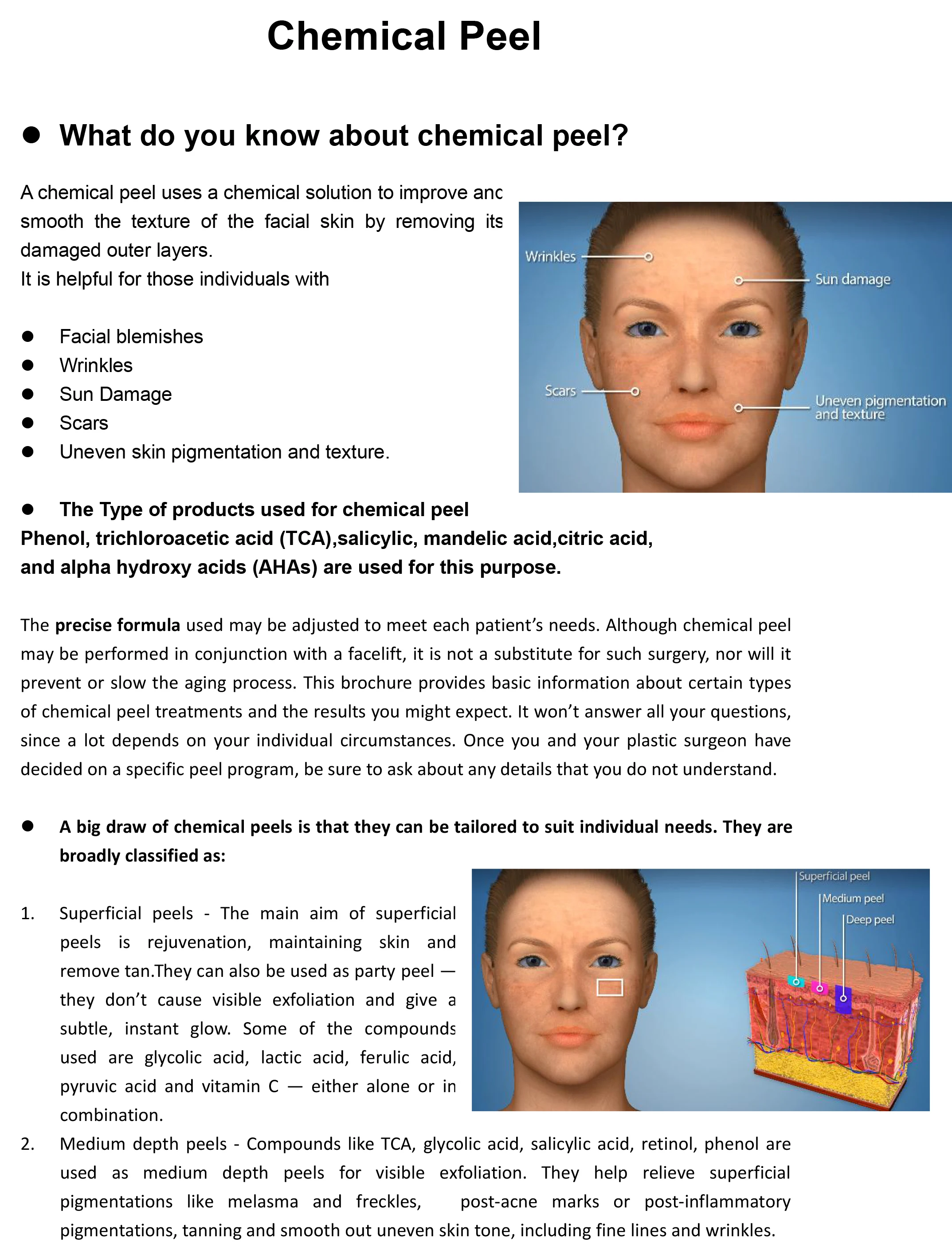 Mandelic Acid 30% 10ml Professional Skin Peel Aha Bha Pha Chemical Peel Serum For Face Body