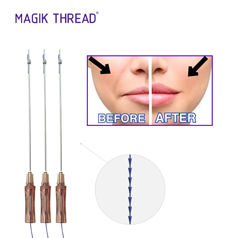 Magik Thread 100mm molding hilos tensores secret line buy best price pdo molding cog thread