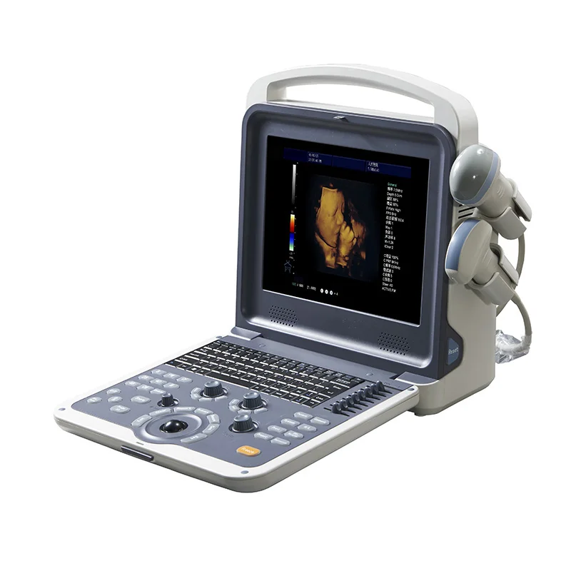 Portable Ultrasound Doppler Diagnostic System for Vascular Imaging