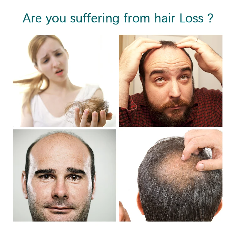 OEM Pro Hair-Anti Hairloss Shampoo 1000ml TCM Ingredients Silicone-Free Chinese Government Certificate