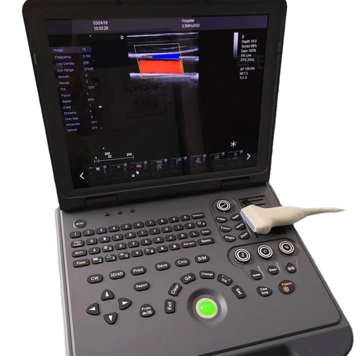 hot selling 2021 style Design latest cardio color doppler & portable doppler ultrasound machine with certificate