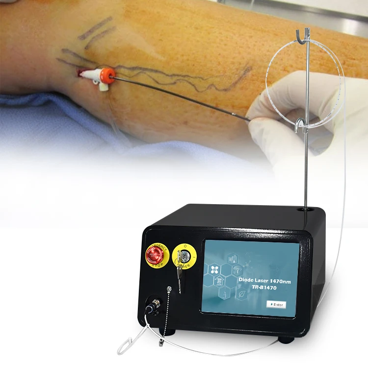 2024 hot sale 1470 nm diode laser evlt endovenous laser varicose varicose vein laser machine