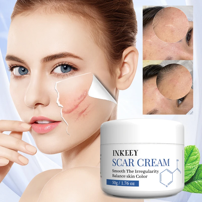 Hot selling effective scar remover old scar on face legs skin repair removal scar cream