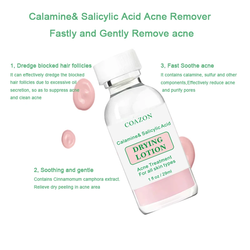 Beaty skin Drying Lotion Overnight Salicylic Acid serum and Sulfur Cystic Acne Spot Treatment for Face and Body