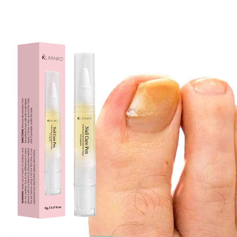 OEM Private Label Personal Nail Fungus Treatment Pen for Repair Foot Toe Nail Fungus Tool Toenail Fingernail Nail Care Products