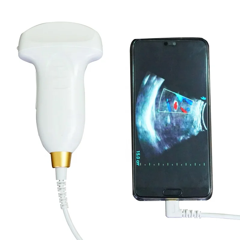 Беспроводной USB цветной Доплер-зонд ультразвуковое устройство сканер ультразвуковой выпуклый зонд для