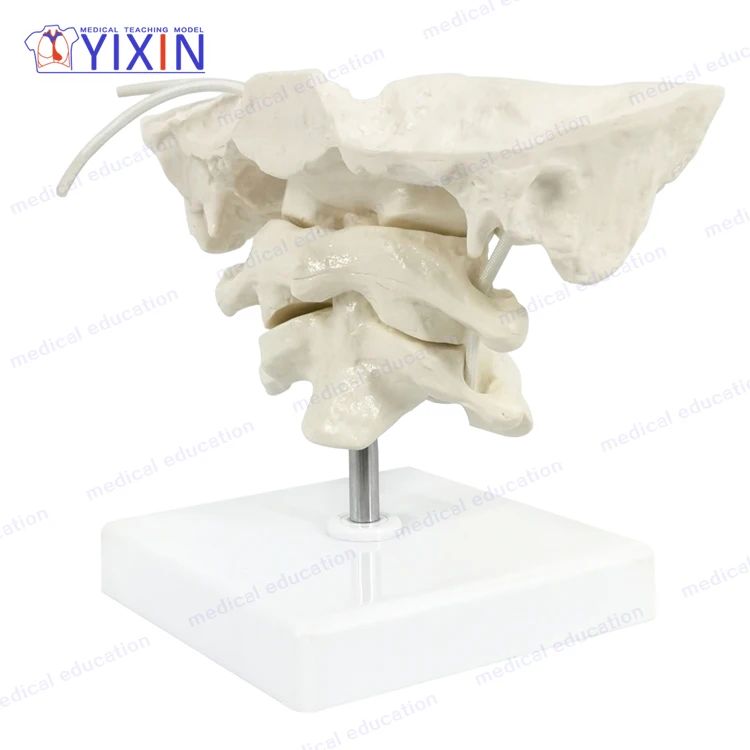 
Human Skeleton Model 1.5 Times Enlarged Occipital Bone, Axis and Atlas for Medical Educational Equipment 