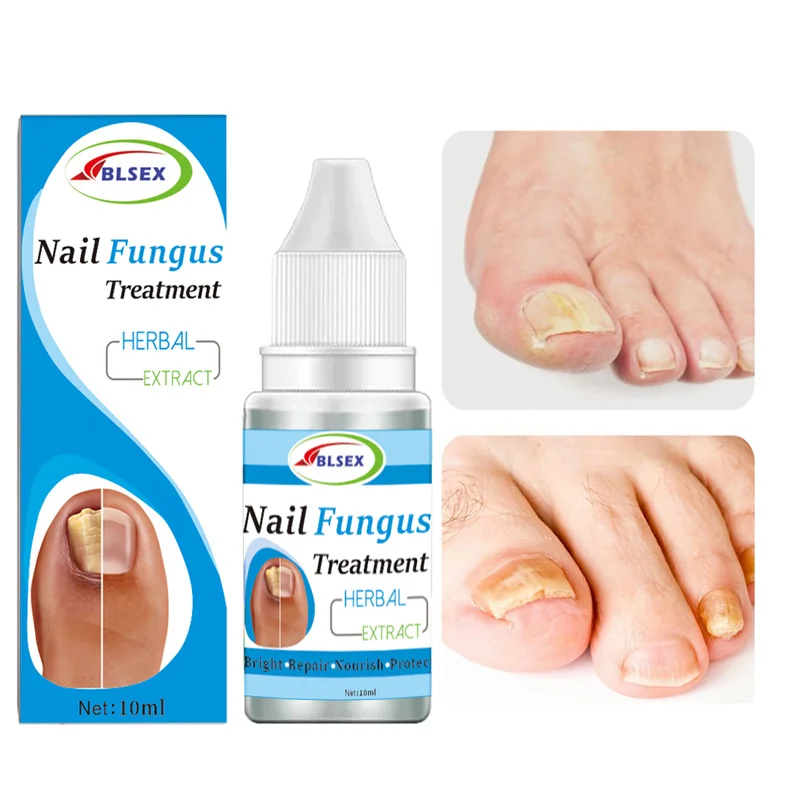 Antifungal Nail Solution for Nail Fungus Treatment Healthy Toenail Growth Repair Fluid with Toe Nail Care Treatments