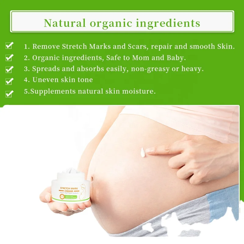 OEM Wholesale Private Label Best Natural Mango Pregnancy Scar Stretch Mark Removal Cream