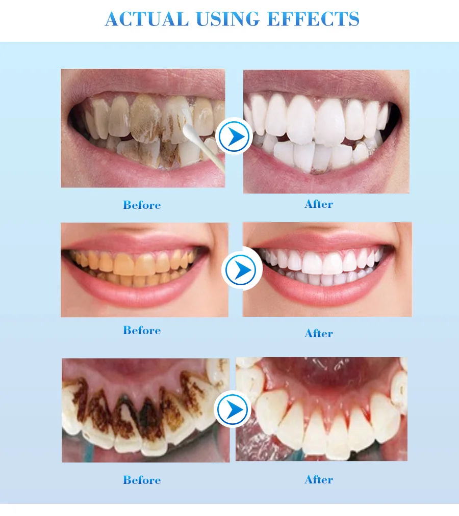 teeth essence (10).jpg