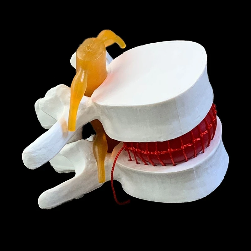 Spine Model Human spine model full size demonstration model of human lumbar intervertebral disc compression for medical teaching